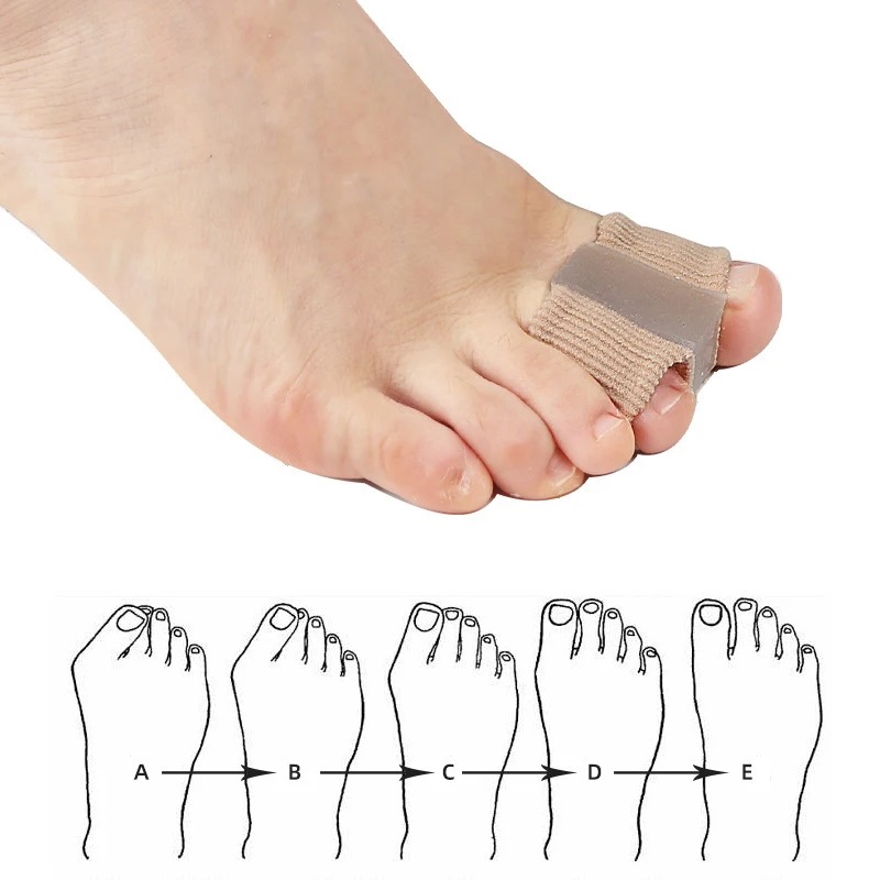 4PC Silicone Toe Separator Fin - Yoga Toe Separator のレビューと価格